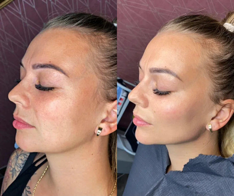 Efekt zabiegu Esthetic Care — Instagram